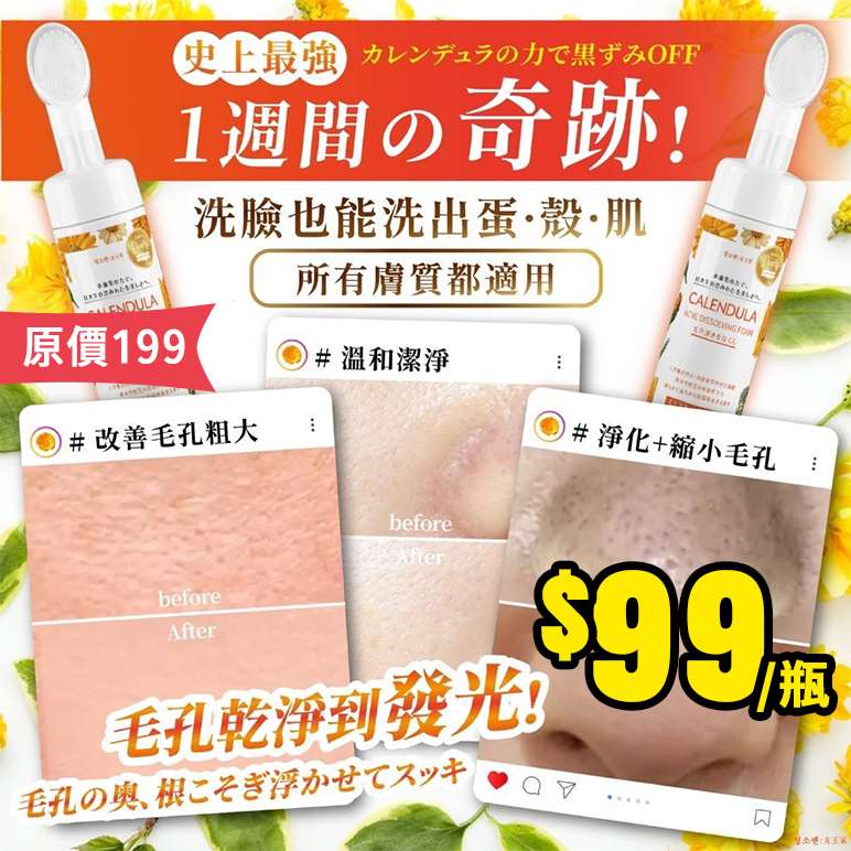 【6/30結單】女王家👑金盞花氧氣泡泡💖洗顏慕斯